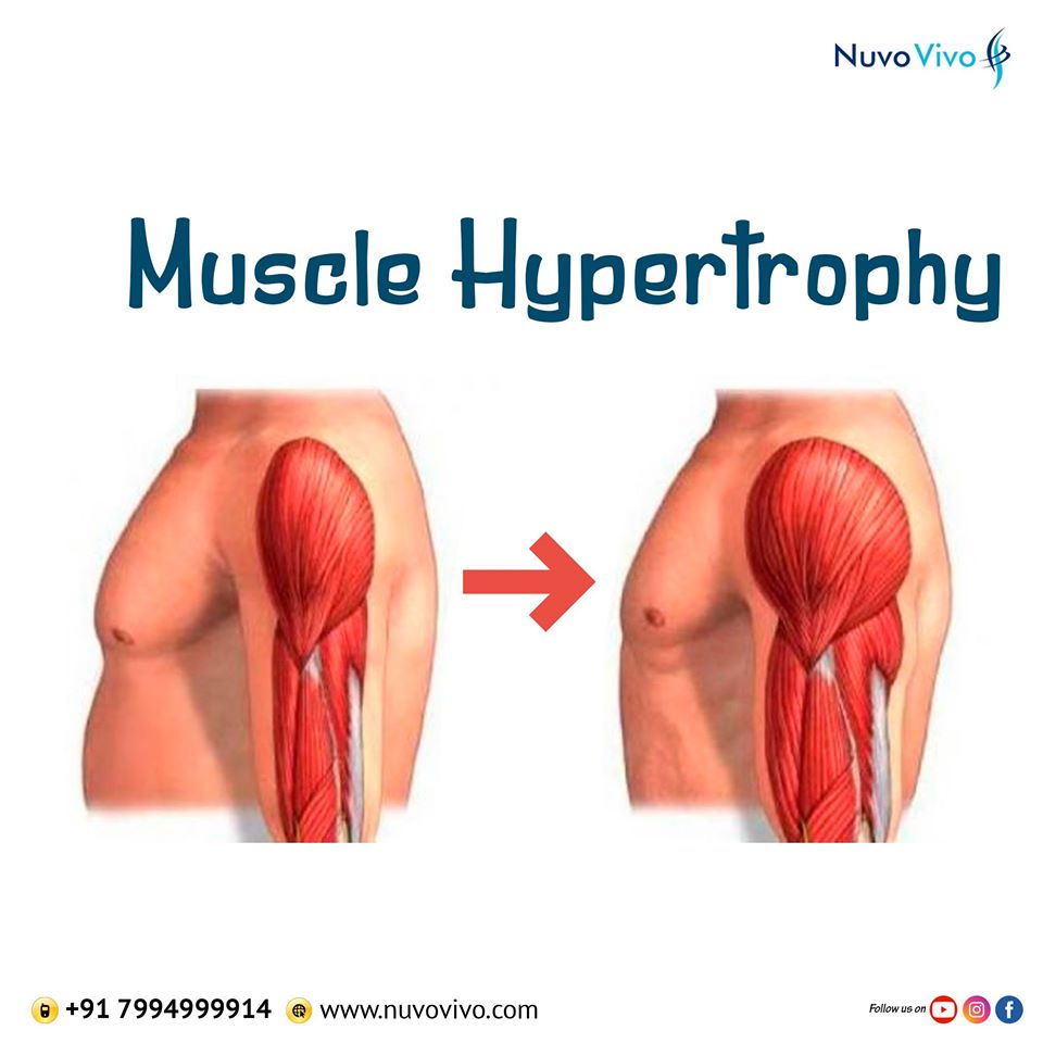 Muscle Hypertrophy