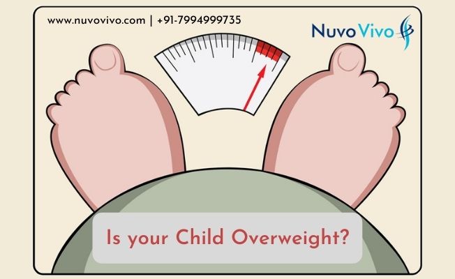 Child obesity - Weight loss diet for children