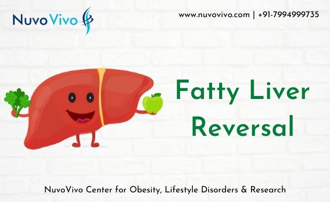 Fatty Liver Reversal Diet