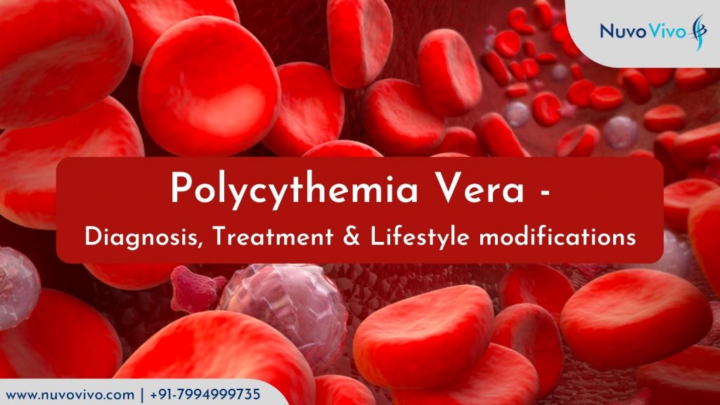 Polycythemia Vera - Diagnosis, Treatment & Lifestyle modifications