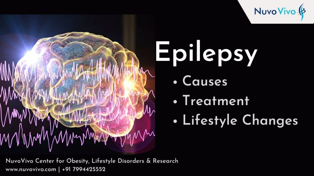 Epilepsy Diet and Exercise